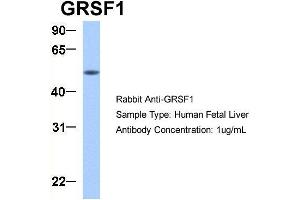 Host:  Rabbit  Target Name:  GRSF1  Sample Type:  Human Fetal Liver  Antibody Dilution:  1. (GRSF1 antibody  (Middle Region))