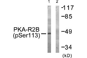 Western blot analysis of extracts from COS-7 cells, treated with A (125 ng/mL, 30 mins), using PKA-R2β (Phospho-Ser113) antibody. (PRKAR2B antibody  (pSer113))