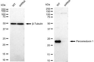 Western blotting analysis using Peroxiredoxin 1 antibody (ABIN7799776).