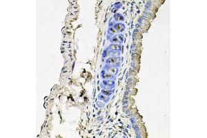 Immunohistochemistry of paraffin-embedded mouse lung using SLC39A4 antibody (ABIN5971796) at dilution of 1/100 (40x lens).