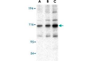 Western blot analysis of TRAF2 in mouse liver tissue lysate with TRAF2 polyclonal antibody  at (A) 0.