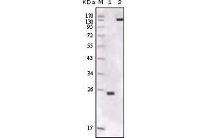 Western Blotting (WB) image for anti-FER Tyrosine Kinase (FER) (truncated) antibody (ABIN2464050) (FER antibody  (truncated))