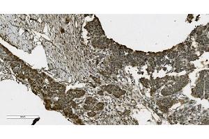 IHC analysis of PARP using anti-PARP antibody (ABIN7602276). (PARP1 antibody  (AA 670-858))