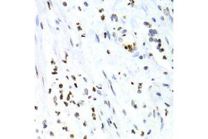 Immunohistochemistry (Paraffin-embedded Sections) (IHC (p)) image for anti-Nuclear Factor of kappa Light Polypeptide Gene Enhancer in B-Cells 2 (NFKB2) (AA 690-899) antibody (ABIN3017388)