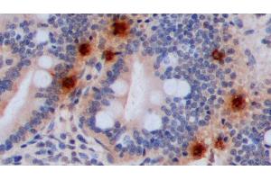Detection of 5-HT in Porcine Small intestine Tissue using Polyclonal Antibody to 5-Hydroxytryptamine (5-HT) (Serotonin antibody)