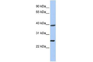 WB Suggested Anti-C12orf42 Antibody Titration: 0. (C12orf42 antibody  (N-Term))