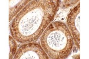 Immunohistochemistry of SPATA6 in mouse testis tissue with SPATA6 antibody at 2.