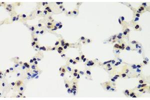 Immunohistochemistry of paraffin-embedded Rat lung using RNF2 Polyclonal Antibody at dilution of 1:100 (40x lens). (RNF2 antibody)