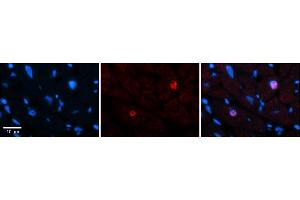 Rabbit Anti-LBX1 Antibody    Formalin Fixed Paraffin Embedded Tissue: Human Adult heart  Observed Staining: Nuclear (rare) Primary Antibody Concentration: 1:600 Secondary Antibody: Donkey anti-Rabbit-Cy2/3 Secondary Antibody Concentration: 1:200 Magnification: 20X Exposure Time: 0.
