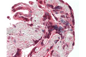 Human Placenta: Formalin-Fixed, Paraffin-Embedded (FFPE) (DAP Kinase 1 antibody  (AA 38-374))