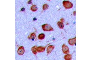 Immunohistochemical analysis of GPR119 staining in human brain formalin fixed paraffin embedded tissue section. (G Protein-Coupled Receptor 119 antibody  (Center))