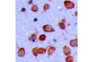 Immunohistochemical analysis of GPR119 staining in human brain formalin fixed paraffin embedded tissue section.