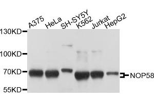 Western blot analysis of extracts of various cells, using NOP58 antibody. (NOP58 antibody)