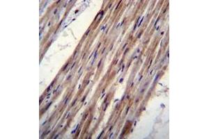 Immunohistochemistry analysis in formalin fixed and paraffin embedded human heart tissue reacted with KCNJ8 Antibody (N-term) followed which was peroxidase conjugated to the secondary antibody and followed by DAB staining. (KCNJ8 antibody  (N-Term))
