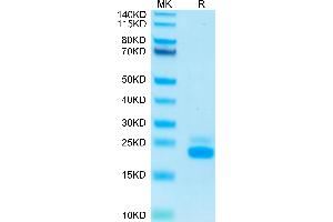 TNFRSF10B Protein (AA 56-182) (His-Avi Tag)