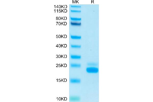 TNFRSF10B Protein (AA 56-182) (His-Avi Tag)