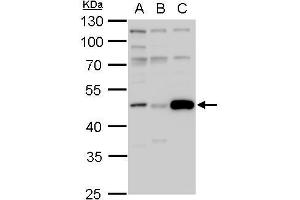WB Image IDH1 antibody detects IDH1 protein by western blot analysis. (IDH1 antibody  (Center))