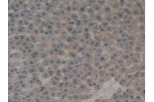 IHC-P analysis of Rat Liver Tissue, with DAB staining. (PAI1 antibody  (AA 24-402))
