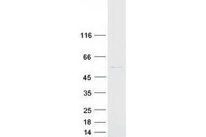 Validation with Western Blot (CYP2R1 Protein (Myc-DYKDDDDK Tag))