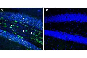 Expression of CCKBR in mouse hippocampus. (CCKBR antibody  (Extracellular))