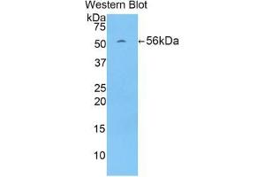 Western blot analysis of the recombinant protein. (LMYC antibody  (AA 186-439))