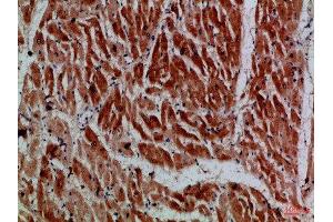Immunohistochemical analysis of paraffin-embedded Human-heart, antibody was diluted at 1:100 (MYH6/MYH7 (AA 1871-1920) antibody)