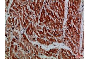 Immunohistochemical analysis of paraffin-embedded Human-heart, antibody was diluted at 1:100 (MYH6 antibody)