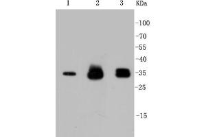 Lane 1: HeLa Cell lysates, Lane 2: PC12 Cell lysates, Lane 3: SH-SY5Y Cell lysates,probed with Cyclin D1 (2H4) Monoclonal Antibody  at 1:1000 overnight at 4˚C. (Cyclin D1 antibody)