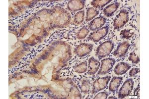 Formalin-fixed and paraffin embedded rat colon labeled with Rabbit Rabbit Anti-CISD1 Polyclonal Antibody, Unconjugated (ABIN2173059) at 1:200 followed by conjugation to the secondary antibody and DAB staining (CISD1 antibody  (AA 51-108))