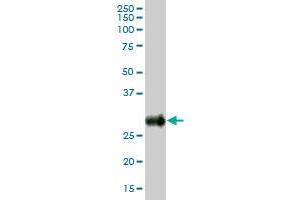 Western Blotting (WB) image for anti-Bone Marrow Stromal Cell Antigen 2 (BST2) (AA 1-180) antibody (ABIN513817)