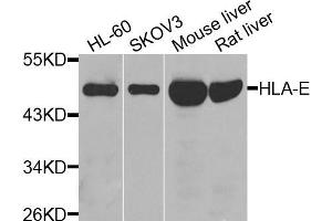 Western blot analysis of extracts of various cell lines, using HLA-E antibody (ABIN5974852) at 1/1000 dilution. (HLA-E antibody)