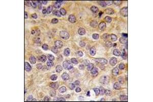 Image no. 2 for anti-Protein Arginine Methyltransferase 3 (PRMT3) (N-Term) antibody (ABIN356524) (PRMT3 antibody  (N-Term))