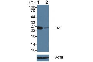 Knockout Varification: ;Lane 1: Wild-type 293T cell lysate; ;Lane 2: TK1 knockout 293T cell lysate; ;Predicted MW: 25kDaa ;Observed MW: 26kDa;Primary Ab: 3µg/ml Rabbit Anti-Human TK1 Antibody;Second Ab: 0.