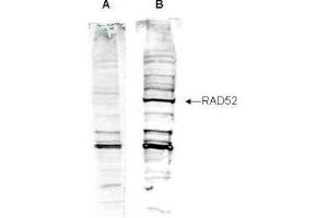 Western blot analysis is shown using  Affinity Purified anti-Human RAD52 antibody to detect Human RAD52 present in a HeLa nuclear extract (panel B). (RAD52 antibody  (AA 36-0))