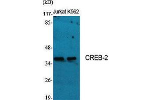 Western Blotting (WB) image for anti-Activating Transcription Factor 4 (Tax-Responsive Enhancer Element B67) (ATF4) (Ser159) antibody (ABIN3174554) (ATF4 antibody  (Ser159))