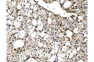 IHC analysis of C-Jun/JUN using anti-C-Jun/JUN antibody (ABIN7601421). (C-JUN antibody  (AA 35-331))