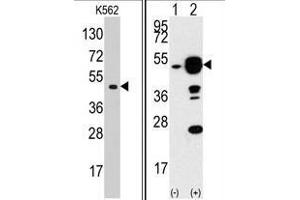 Left: Western blot analysis of EIF4A1 Antibody (N-term) in K562 cell line lysates (35 µg/lane).