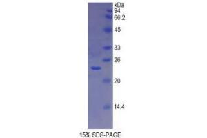 SDS-PAGE analysis of Dog MHCDRa Protein. (HLA-DRA Protein)