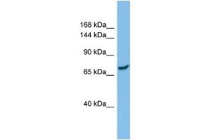 Host:  Rabbit  Target Name:  SLC8A1  Sample Type:  ACHN Whole Cell lysates  Antibody Dilution:  1. (SLC8A1 antibody  (N-Term))
