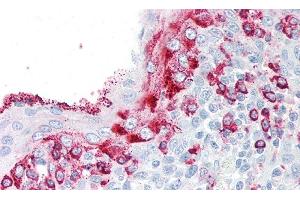 Detection of KLK8 in Human Tonsil Tissue using Polyclonal Antibody to Kallikrein 8 (KLK8) (Kallikrein 8 antibody  (AA 29-260))