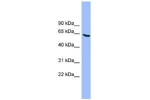 WB Suggested Anti-DYRK3 Antibody Titration: 0. (DYRK3 antibody  (N-Term))