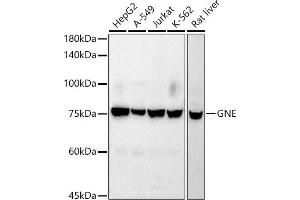 Western blot analysis of extracts of various cell lines, using GNE antibody (ABIN7267398) at 1:1000 dilution. (GNE antibody)