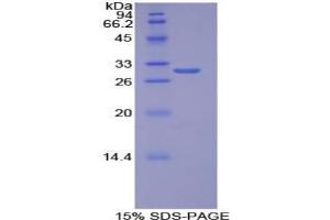SDS-PAGE analysis of Human Torsin 1B Protein.