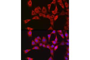 Immunofluorescence analysis of NIH/3T3 cells using RBCK1 antibody (ABIN7269848) at dilution of 1:100. (RBCK1 antibody)