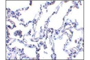 AP30640PU-N p53R2 antibody staining of Human lung tissue by Immunohistochemistry at 1 μg/ml. (RRM2B antibody  (N-Term))