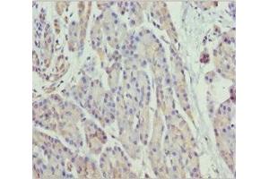 Immunohistochemistry of paraffin-embedded human pancreatic tissue using ABIN7160787 at dilution of 1:100 (SCYL1 antibody  (AA 460-740))