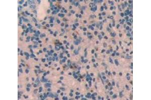 Used in DAB staining on fromalin fixed paraffin- embedded Kidney tissue (STING/TMEM173 antibody  (AA 160-371))