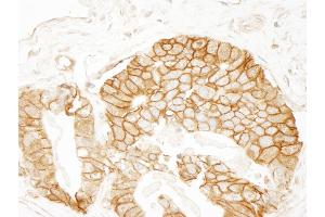 Immunohistochemistry (IHC) image for anti-Catenin, beta (CATNB) (AA 760-781) antibody (ABIN7448432) (beta Catenin antibody  (AA 760-781))