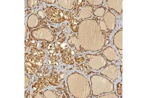 IHC analysis of SNX4 using anti-SNX4 antibody (ABIN7599406). (Sorting Nexin 4 antibody  (AA 1-450))