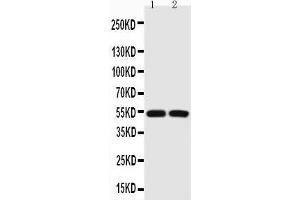 Anti-P53 Picoband antibody,  All lanes: Anti-P53 at 0. (p53 antibody  (AA 74-393))
